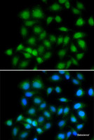 Immunofluorescence analysis of HeLa cells using MXI1 Polyclonal Antibody