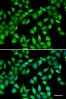 Immunofluorescence analysis of U2OS cells using MYL3 Polyclonal Antibody