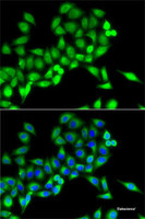 Immunofluorescence analysis of MCF7 cells using NFS1 Polyclonal Antibody