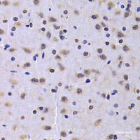 Immunohistochemistry of paraffin-embedded Rat brain using NUDC Polyclonal Antibody at dilution of 1:100 (40x lens) .