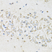 Immunohistochemistry of paraffin-embedded Mouse brain using NUDC Polyclonal Antibody at dilution of 1:100 (40x lens) .