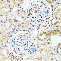Immunohistochemistry of paraffin-embedded Rat kidney using PNKP Polyclonal Antibody at dilution of 1:100 (40x lens) .