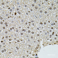 Immunohistochemistry of paraffin-embedded Mouse liver using PNKP Polyclonal Antibody at dilution of 1:100 (40x lens) .