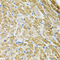 Immunohistochemistry of paraffin-embedded Rat heart using POLG2 Polyclonal Antibody at dilution of 1:100 (40x lens) .