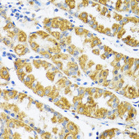 Immunohistochemistry of paraffin-embedded Human stomach using POLG2 Polyclonal Antibody at dilution of 1:100 (40x lens) .