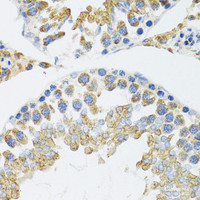 Immunohistochemistry of paraffin-embedded Mouse testis using POLG2 Polyclonal Antibody at dilution of 1:100 (40x lens) .