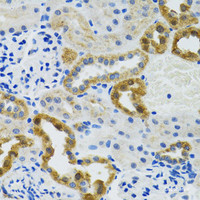 Immunohistochemistry of paraffin-embedded Mouse kidney using POLG2 Polyclonal Antibody at dilution of 1:100 (40x lens) .