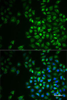 Immunofluorescence analysis of MCF7 cells using POLG2 Polyclonal Antibody