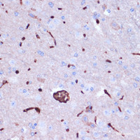 Immunohistochemistry of paraffin-embedded Mouse brain using PROK2 Polyclonal Antibody at dilution of 1:100 (40x lens) .