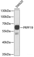 Western blot analysis of extracts of SW620 cells using PRPF19 Polyclonal Antibody at dilution of 1:1000.