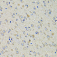 Immunohistochemistry of paraffin-embedded Mouse brain using RAE1 Polyclonal Antibody at dilution of 1:100 (40x lens) .