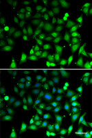 Immunofluorescence analysis of MCF-7 cells using RAE1 Polyclonal Antibody