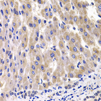 Immunohistochemistry of paraffin-embedded Rat liver using RPL14 Polyclonal Antibody at dilution of 1:100 (40x lens) .