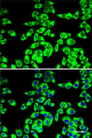 Immunofluorescence analysis of MCF7 cells using RPL14 Polyclonal Antibody