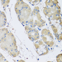 Immunohistochemistry of paraffin-embedded Human stomach using RPLP1 Polyclonal Antibody at dilution of 1:100 (40x lens) .