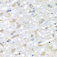 Immunohistochemistry of paraffin-embedded Rat brain using RPLP1 Polyclonal Antibody at dilution of 1:100 (40x lens) .