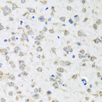 Immunohistochemistry of paraffin-embedded Mouse brain using RPLP1 Polyclonal Antibody at dilution of 1:100 (40x lens) .