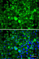 Immunofluorescence analysis of MCF7 cells using RPLP1 Polyclonal Antibody