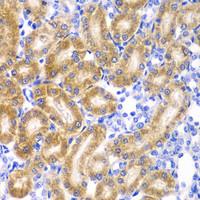 Immunohistochemistry of paraffin-embedded Rat kidney using RPN1 Polyclonal Antibody at dilution of 1:100 (40x lens) .