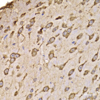 Immunohistochemistry of paraffin-embedded Mouse brain using RPS14 Polyclonal Antibody at dilution of 1:100 (40x lens) .