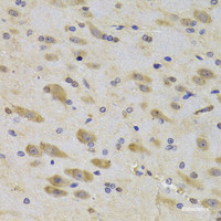 Immunohistochemistry of paraffin-embedded Rat brain using RPS27 Polyclonal Antibody at dilution of 1:100 (40x lens) .