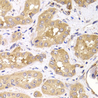 Immunohistochemistry of paraffin-embedded Human kidney using RPS4X Polyclonal Antibody at dilution of 1:100 (40x lens) .