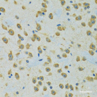 Immunohistochemistry of paraffin-embedded Rat brain using RPS7 Polyclonal Antibody at dilution of 1:100 (40x lens) .
