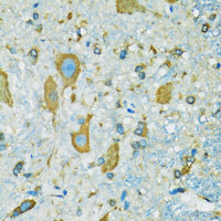 Immunohistochemistry of paraffin-embedded Mouse spinal cord using RPS7 Polyclonal Antibody at dilution of 1:100 (40x lens) .