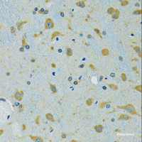 Immunohistochemistry of paraffin-embedded Mouse brain using RPS7 Polyclonal Antibody at dilution of 1:100 (40x lens) .