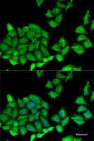 Immunofluorescence analysis of U2OS cells using RPS7 Polyclonal Antibody