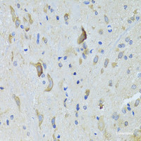 Immunohistochemistry of paraffin-embedded Rat spinal cord using SARS Polyclonal Antibody at dilution of 1:100 (40x lens) .