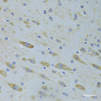 Immunohistochemistry of paraffin-embedded Rat brain using SARS Polyclonal Antibody at dilution of 1:100 (40x lens) .