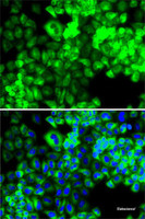 Immunofluorescence analysis of MCF7 cells using SARS Polyclonal Antibody
