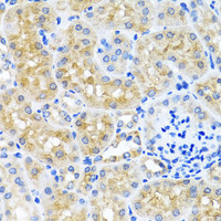 Immunohistochemistry of paraffin-embedded Mouse kidney using SCO1 Polyclonal Antibody at dilution of 1:100 (40x lens) .