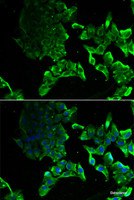 Immunofluorescence analysis of MCF-7 cells using SCYL1 Polyclonal Antibody