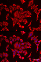 Immunofluorescence analysis of HeLa cells using SLC20A2 Polyclonal Antibody