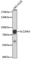 Western blot analysis of extracts of NCI-H125 cells using SLC26A3 Polyclonal Antibody at dilution of 1:1000.