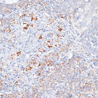 Immunohistochemistry of paraffin-embedded Rat ovary using SMPD1 / ASM Polyclonal Antibody at dilution of 1:100 (40x lens) .