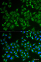 Immunofluorescence analysis of HeLa cells using SMPD1 / ASM Polyclonal Antibody