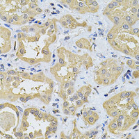 Immunohistochemistry of paraffin-embedded Human kidney using SPTLC1 Polyclonal Antibody at dilution of 1:100 (40x lens) .