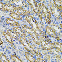 Immunohistochemistry of paraffin-embedded Mouse kidney using SPTLC1 Polyclonal Antibody at dilution of 1:100 (40x lens) .