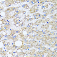 Immunohistochemistry of paraffin-embedded Human liver damage using SRI Polyclonal Antibody at dilution of 1:100 (40x lens) .