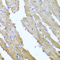 Immunohistochemistry of paraffin-embedded Rat heart using SRI Polyclonal Antibody at dilution of 1:100 (40x lens) .