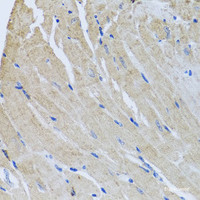 Immunohistochemistry of paraffin-embedded Mouse heart using SRI Polyclonal Antibody at dilution of 1:100 (40x lens) .