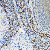 Immunohistochemistry of paraffin-embedded Rat ovary using SRP19 Polyclonal Antibody at dilution of 1:100 (40x lens) .