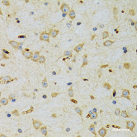 Immunohistochemistry of paraffin-embedded Rat brain using SRP19 Polyclonal Antibody at dilution of 1:100 (40x lens) .