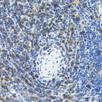 Immunohistochemistry of paraffin-embedded Rat spleen using SRP19 Polyclonal Antibody at dilution of 1:100 (40x lens) .