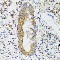 Immunohistochemistry of paraffin-embedded Human vermiform appendix using SRP19 Polyclonal Antibody at dilution of 1:100 (40x lens) .