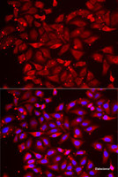 Immunofluorescence analysis of MCF7 cells using SRP19 Polyclonal Antibody