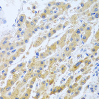 Immunohistochemistry of paraffin-embedded Human liver using STC1 Polyclonal Antibody at dilution of 1:100 (40x lens) .
